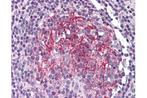 Anti-IL1R2 antibody IHC of human small intestine, Peyer's patch.