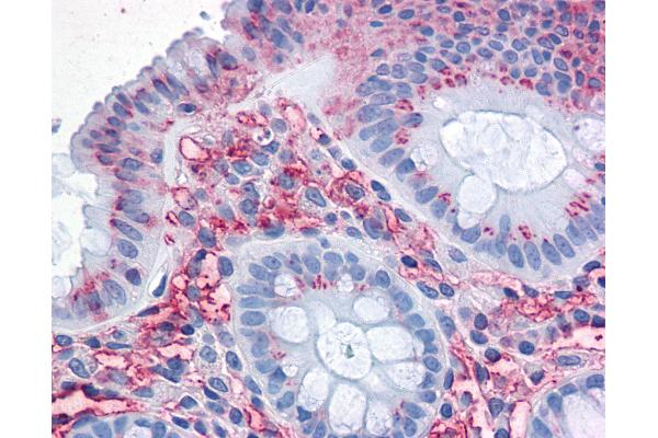 SLC1A5 antibody  (Internal Region)