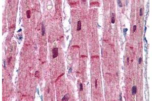 Human Heart: Formalin-Fixed, Paraffin-Embedded (FFPE) (ACTN2 antibody  (AA 215-500))