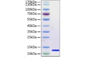 Recombinant 2019-nCoV envelope Protein was determined by SDS-PAGE with Coomassie Blue, showing a band at 12 kDa.