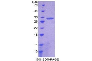 SDS-PAGE (SDS) image for Antigen Identified By Monoclonal Antibody Ki-67 (MKI67) (AA 1-247) protein (His tag) (ABIN1878972) (Ki-67 Protein (AA 1-247) (His tag))