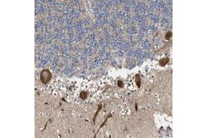 Immunohistochemical staining of human cerebellum with MFSD6 polyclonal antibody  shows strong cytoplasmic positivity in Purkinje cells. (MFSD6 antibody)