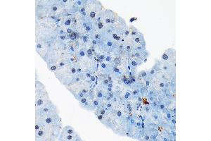 Immunohistochemistry (IHC) image for anti-TAR (HIV-1) RNA Binding Protein 2 (TARBP2) antibody (ABIN7270729)