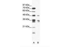 Image no. 1 for anti-Zinc Finger Protein 577 (ZNF577) (AA 373-422) antibody (ABIN202626)