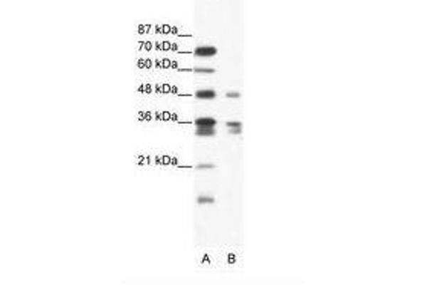 ZNF577 anticorps  (AA 373-422)