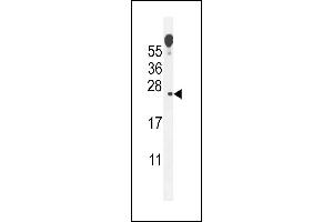 ECOP Antibody (Center) (ABIN655147 and ABIN2844768) western blot analysis in mouse lung tissue lysates (35 μg/lane). (VOPP1 antibody  (AA 65-95))