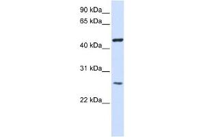 TMEM127 antibody used at 1 ug/ml to detect target protein. (TMEM127 antibody  (Middle Region))