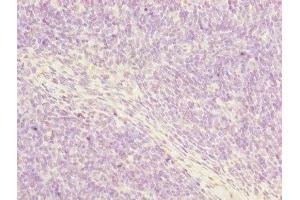 Immunohistochemistry of paraffin-embedded human thymus tissue using ABIN7162915 at dilution of 1:100 (Periostin antibody  (AA 24-836))