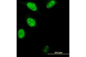 Immunofluorescence of monoclonal antibody to FOXM1 on HeLa cell. (FOXM1 antibody  (AA 22-110))