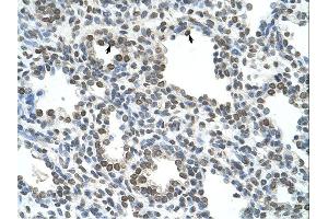 NKD1 antibody was used for immunohistochemistry at a concentration of 4-8 ug/ml. (NKD1 antibody)