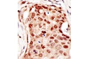 Image no. 2 for anti-Cbl proto-oncogene C (CBLC) (C-Term) antibody (ABIN356779) (CBLC antibody  (C-Term))