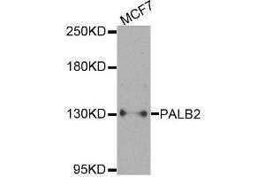 Western blot analysis of extracts of MCF7 cells, using PALB2 antibody.