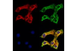 ABIN6261040 and ABIN6273217 staining Hela cells by IF/ICC. (CRLS1 antibody  (Internal Region))