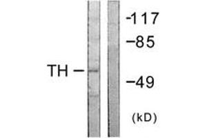 Western Blotting (WB) image for anti-Tyrosine Hydroxylase (TH) (AA 5-54) antibody (ABIN2888712) (Tyrosine Hydroxylase antibody  (AA 5-54))