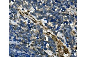 IHC analysis of RBPMS using anti-RBPMS antibody (ABIN7602120). (RBPMS antibody  (AA 6-196))