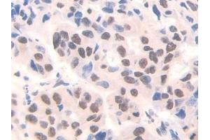 Immunohistochemistry (IHC) image for anti-Family with Sequence Similarity 19 (Chemokine (C-C Motif)-Like), Member A3 (FAM19A3) (AA 44-130) antibody (ABIN7441964)