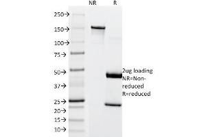 SDS-PAGE Analysis Purified MITF Mouse Monoclonal Antibody (SPM290).