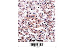 RCAN3 Antibody immunohistochemistry analysis in formalin fixed and paraffin embedded human liver tissue followed by peroxidase conjugation of the secondary antibody and DAB staining. (RCAN3 antibody  (C-Term))