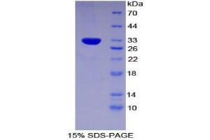 SDS-PAGE (SDS) image for Forkhead Box O1 (FOXO1) (AA 222-469) protein (His tag) (ABIN2124863)