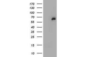 HEK293T cells were transfected with the pCMV6-ENTRY control (Left lane) or pCMV6-ENTRY PGM3 (Right lane) cDNA for 48 hrs and lysed. (Phosphoglucomutase 3 antibody)