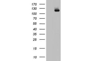 Western Blotting (WB) image for anti-ADAM Metallopeptidase with Thrombospondin Type 1 Motif, 1 (ADAMTS1) (AA 412-644) antibody (ABIN2715714) (ADAMTS1 antibody  (AA 412-644))