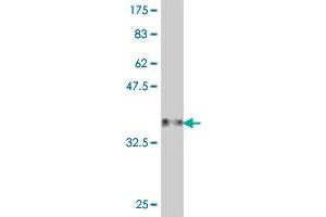 Western Blot detection against Immunogen (37 KDa) . (ADH4 antibody  (AA 52-150))