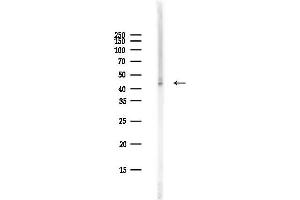 anti-Adenosine Kinase (ADK) (N-Term) antibody