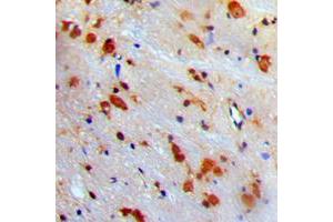 Immunohistochemical analysis of VCP staining in human brain formalin fixed paraffin embedded tissue section. (VCP antibody  (Center))