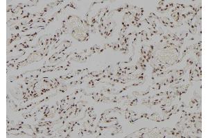 ABIN6278978 at 1/100 staining Human lung tissue by IHC-P. (RFC5 antibody  (Internal Region))