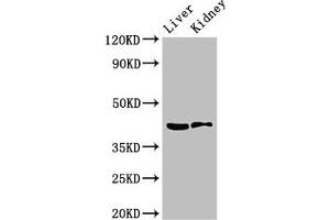 Western Blot Positive WB detected in: Mouse liver tissue, Mouse kidney tissue All lanes: HSD3B7 antibody at 3. (HSD3B7 antibody  (AA 131-197))