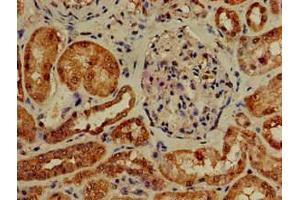 Immunohistochemistry of paraffin-embedded human kidney tissue using ABIN7163291 at dilution of 1:100 (PIK3R4 antibody  (Regulatory Subunit 4))