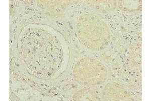 Immunohistochemistry of paraffin-embedded human kidney tissue using ABIN7142279 at dilution of 1:100 (MRPS6 antibody  (AA 1-125))
