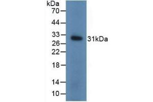 Detection of Recombinant UCHL1, Mouse using Polyclonal Antibody to Ubiquitin Carboxyl Terminal Hydrolase L1 (UCHL1) (UCHL1 antibody  (AA 2-223))