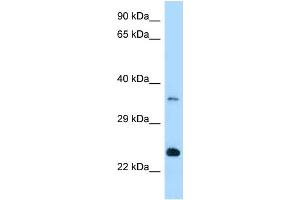 WB Suggested Anti-Rab13 Antibody Titration: 1. (RAB13 antibody  (Middle Region))