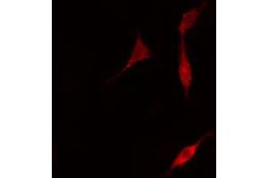 ABIN6266510 staining A549 cells by IF/ICC. (Claudin 5 antibody  (C-Term))