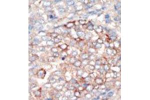 Image no. 2 for anti-Phosphoinositide 3-kinase Regulatory Subunit 4 (PIK3R4) (N-Term) antibody (ABIN360462) (PIK3R4 antibody  (N-Term))