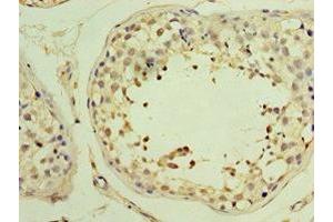 Immunohistochemistry of paraffin-embedded human testis tissue using ABIN7174000 at dilution of 1:100 (YARS2 antibody  (AA 228-477))
