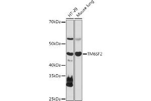 Western blot analysis of extracts of various cell lines, using TM6SF2 antibody (ABIN7270937) at 1:1000 dilution. (TM6SF2 antibody)