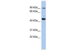 KCNH2 antibody used at 1 ug/ml to detect target protein.