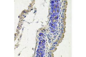 Immunohistochemistry of paraffin-embedded mouse lung using SKP1 antibody (ABIN5971391) at dilution of 1/100 (40x lens). (SKP1 antibody)