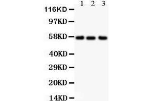 All lanes: Anti ALPL () at 0. (ALPL antibody  (N-Term))