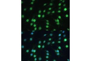 Immunofluorescence analysis of C6 cells using LBR Polyclonal Antibody (ABIN6128194, ABIN6143105, ABIN6143106 and ABIN6221130) at dilution of 1:100 (40x lens). (Lamin B Receptor antibody  (AA 1-211))