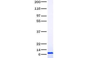 Validation with Western Blot (CCL5 Protein)