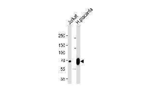 Western blot analysis of lysates from Jurkat cell line and human placenta tissue lysate (from left to right), using LIMK2 Antibody at 1:1000 at each lane. (LIMK2 antibody  (C-Term))