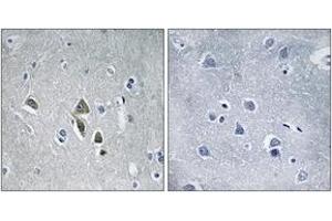 Immunohistochemistry (IHC) image for anti-Ornithine Decarboxylase Antizyme 1 (OAZ1) (AA 14-63) antibody (ABIN2890479) (OAZ1 antibody  (AA 14-63))
