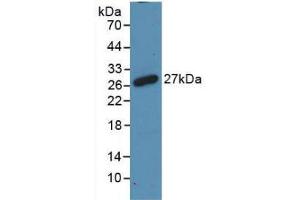 Western blot analysis of recombinant Rat RANk. (TNFRSF11A antibody  (AA 31-214))