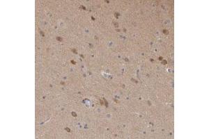 Immunohistochemical staining (Formalin-fixed paraffin-embedded sections) of human cerebral cortex with SCRN1 polyclonal antibody  shows moderate cytoplasmic positivity in neuronal cells.