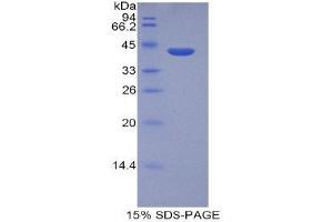 SDS-PAGE (SDS) image for Histone Cluster 2, H2aa3 (HIST2H2AA3) (AA 1-130) protein (His tag,GST tag) (ABIN2122987)