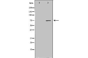 Western blot analysis of extracts of Mouse fetal kidney tissue lysate, using CPT2 antibody. (CPT2 antibody  (Internal Region))