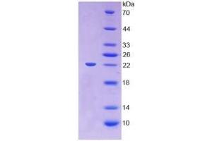 SDS-PAGE (SDS) image for Lecithin-Cholesterol Acyltransferase (LCAT) (AA 41-210) (Active) protein (His tag) (ABIN6239826)